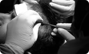 Procedure